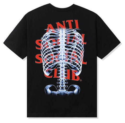 Anti Social Social Club Bones Black Tee